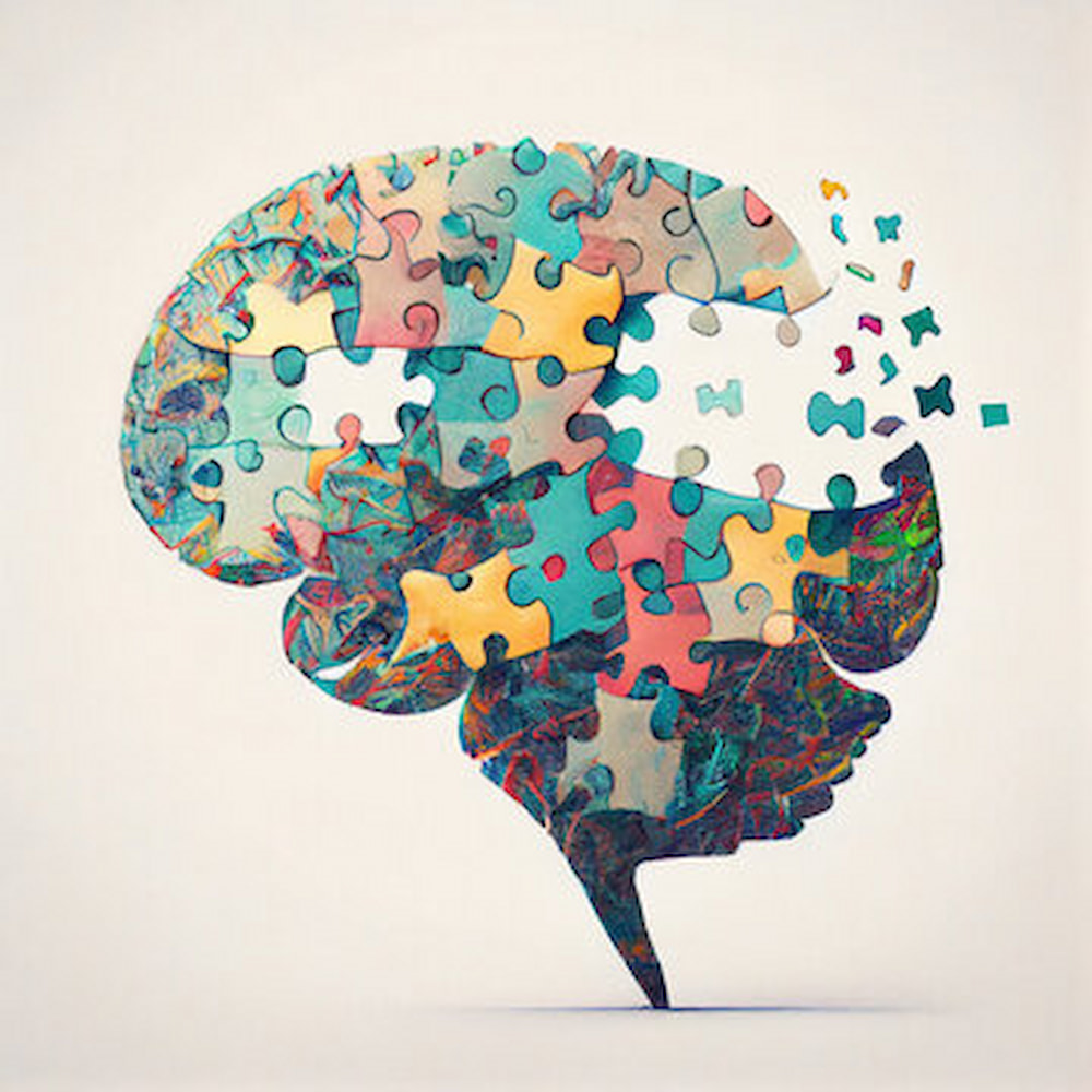 Alzheimer brain depiction